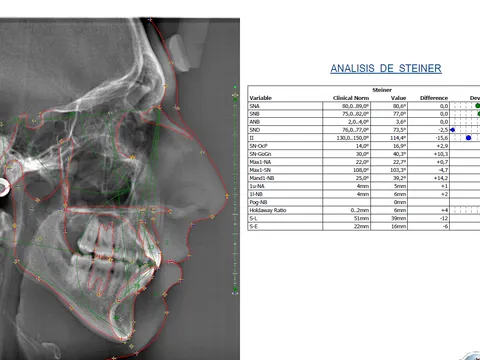 Ejemplo de modelos de estudio y análisis cefalométrico tomada en El Radiológico Oral