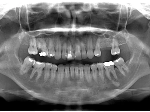 Ejemplo de radiografías extraorales tomada en El Radiológico Oral
