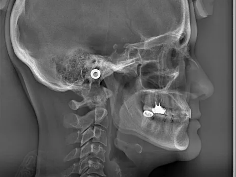 Ejemplo de paquetes de ortodoncia tomada en El Radiológico Oral